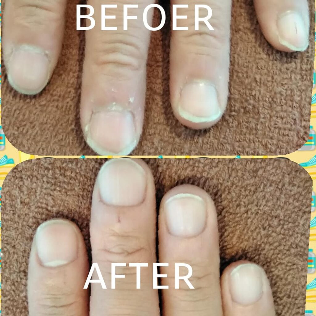 チーフtakeのブログ　ブライダルネイルは新婦だけじゃない　新郎の爪のケアは大丈夫?